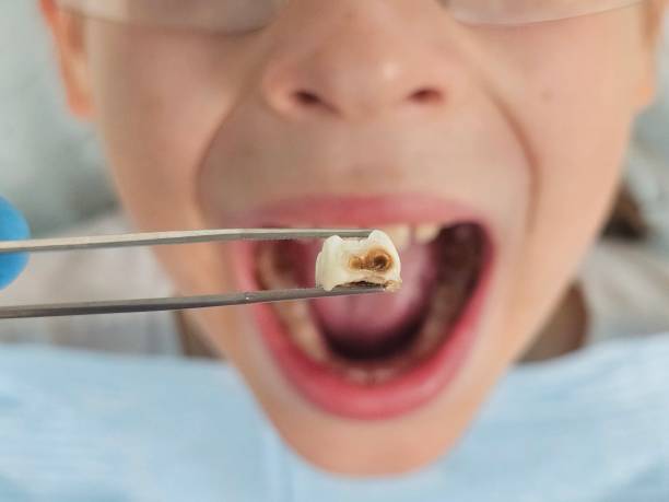 Best Same-Day Emergency Dental Services in Four Oaks, NC