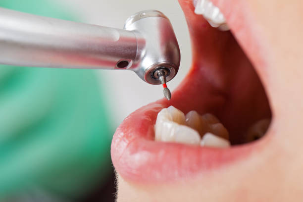 Best Weekend Emergency Dentist in Four Oaks, NC